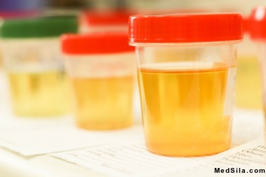 Анализ мочи